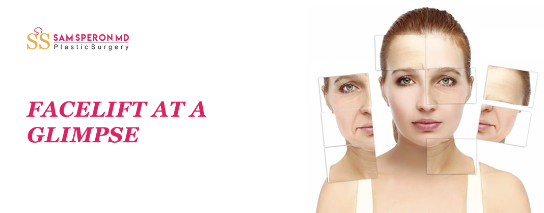 Advantages of a Facelift Surgery