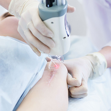 Laser Treatment Procedures