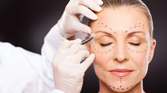 Steps for facelift surgery