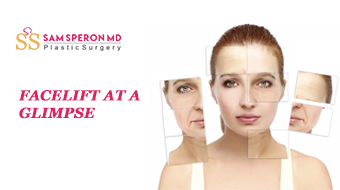 Improve your facial appearance with the best Facelift Surgery clinic: